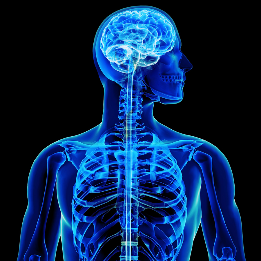 X-Ray
